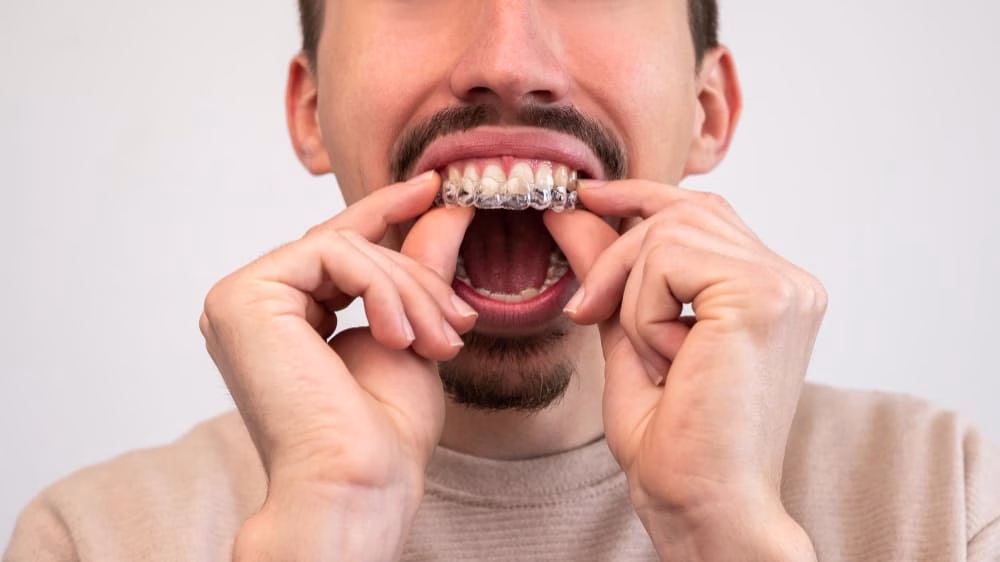 Additional Bruxism Treatment Options