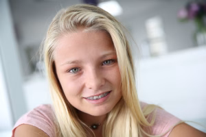 A close-up of a young woman with braces.