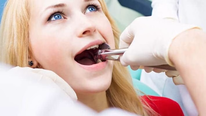 Stress free Wisdom Tooth extraction – what to expect during and after the procedure