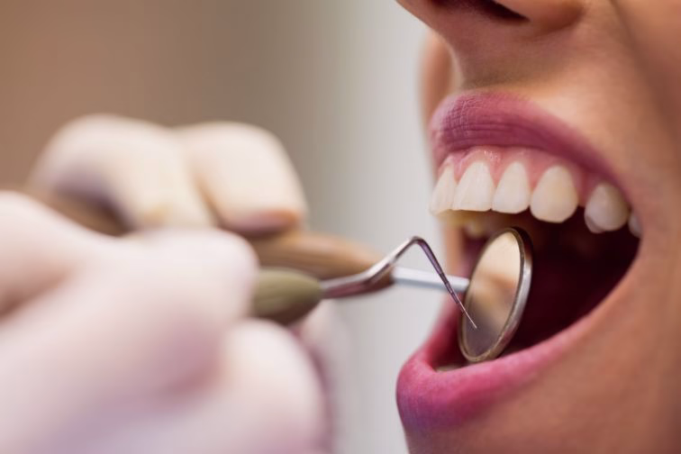 Supernumerary Teeth – How Should Your Extra Teeth Be Treated